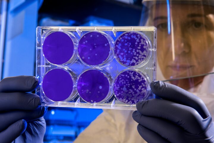 laboratory scientist examines a tray of blue petri dishes