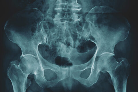 X-ray of a pelvis.